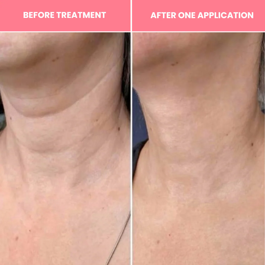 Korean Bio-Collagen Necklift Mask - Younger Neck After 1 Use